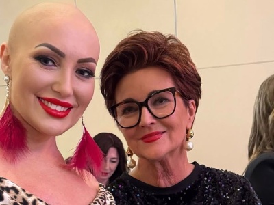 Pokochała swoją łysinę. 