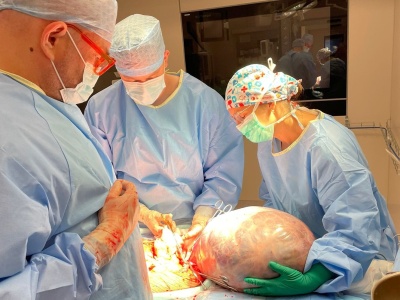 Gigantyczny guz jajnika usunęli mieszkance regionu onkolodzy z Bydgoszczy [zdjęcia]