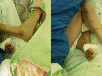 Wstrząsająca relacja z kłodzkiego szpitala