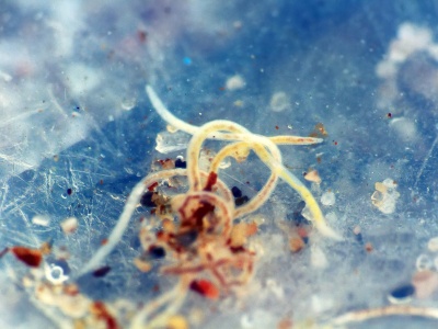 Jak wygląda owsik? Najwięcej pasożytów wychodzi w nocy