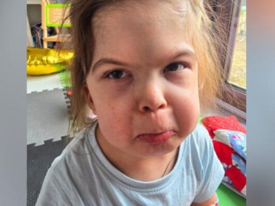 Nie do wiary! Ponad milion złotych od firmy Roberta Lewandowskiego. 7-letnia Amelka z Wójtowa przejdzie operację w Bostonie