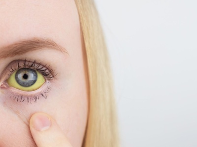 Zdążyć przed żółtym