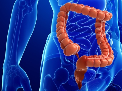 Badanie wykazało, że to wydarzenie z dzieciństwa sprzyja rozwojowi raka jelita grubego