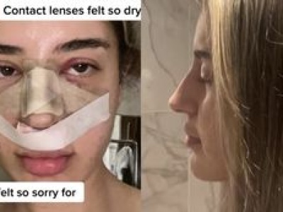 Poleciała do Turcji, żeby zoperować nos. Nie wszystko poszło tak, jak się spodziewała: 