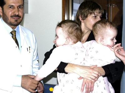 Bliźniaczki syjamskie z Janikowa po 20 latach od rozdzielenia