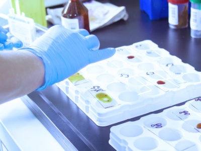 Akredytacje zakładów patomorfologii zostaną przedłużone? 