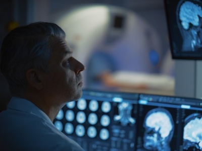 Nadzieja dla pacjentów z glejakiem? Wiemy, kto może skorzystać terapii