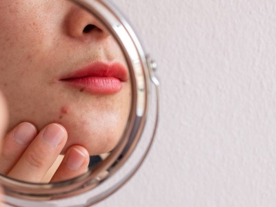 Obsesja na punkcie skóry. 