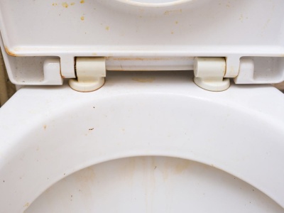 Paskudne zacieki i żółte plamy znikają od razu. Wystarczy posypać je tym proszkiem