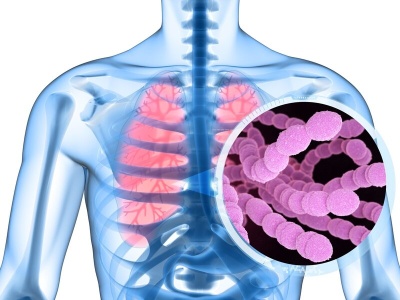 Eksperci: Szczepionki na pneumokoki nie są dostosowane do realnych zagrożeń
