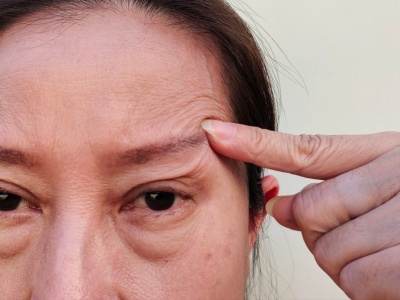 Opadająca powieka? Nie wydawaj fortuny na kremy i zabiegi. Ten trik działa, a nic nie kosztuje