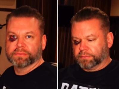 Znany producent muzyczny pobity w barze! Pokazał obrażenia. 