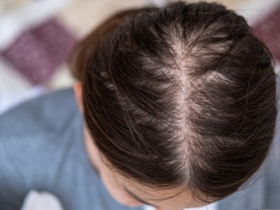 Twoje włosy są rzadkie i oklapnięte? Ten domowy sposób działa lepiej niż maski za 100 zł