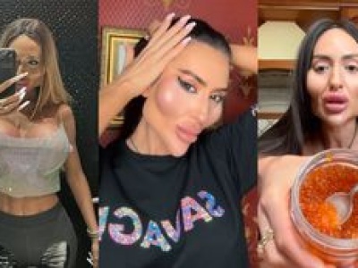 Mówi, że ma NAJWIĘKSZE POLICZKI NA ŚWIECIE. 37-latka wydała na to fortunę. Nie uwierzycie, jak wyglądała 