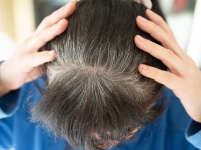 Zrób ten napar i zapomnij o siwieniu włosów. Wystarczy jeden produkt z kuchni