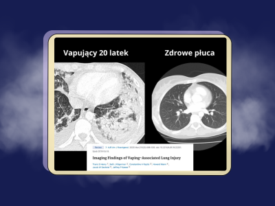 Tradycyjne papierosy kontra e-papierosy – czy można mówić o zdrowszej alternatywie?