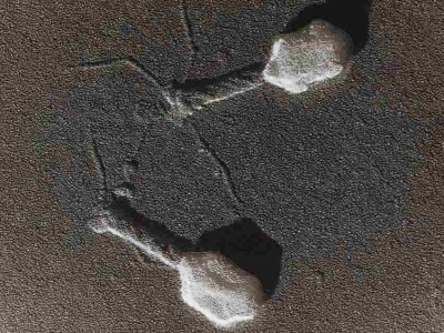 Bakteriofagi kontra rak. Wirusy, które mogą pomóc w walce z nowotworami