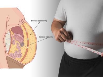 Kwestia kształtu? Zrozumienie i przeciwdziałanie insulinooporności