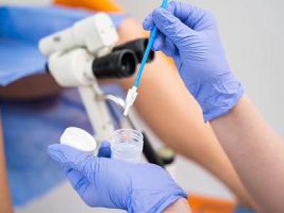 Cytologia bez cytologii. To badanie sprawdza, czy masz groźnego wirusa