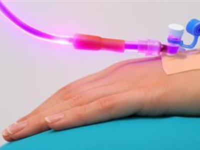 Jak wprowadzenie promieniowania UV do krwi leczy wszystko, od infekcji po choroby serca