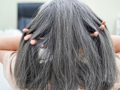 Siwe włosy mogą zdradzać coś więcej niż wiek. Naukowcy odkryli zaskakujący mechanizm