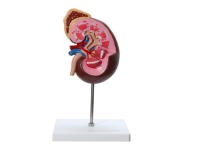 Hiperaldosteronizm – przyczyny, objawy i leczenie