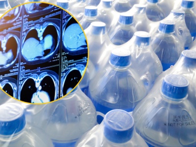 Toksyczne dla wątroby. Naukowcy:  zmiany są groźne - komórki obumierają