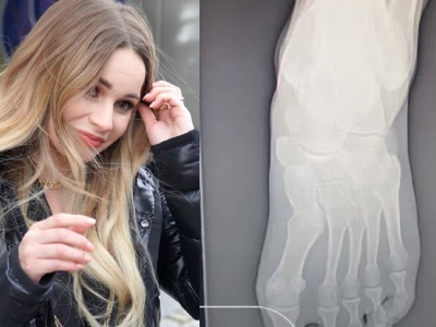 Ewelina Lisowska nabawiła się poważnej kontuzji. 