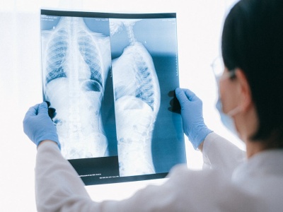 Algorytmy AI wykrywają raka trzustki wcześniej i dokładniej niż radiolodzy – przełomowe ustalenia