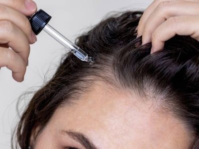 To serum na wypadanie włosów zatrzymuje nawet łysienie! Rosną po nim jak na drożdżach