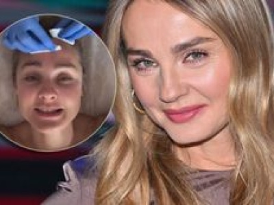 Wydał się sekret urody Małgorzaty Sochy. Gwiazda traktuje twarz prądem