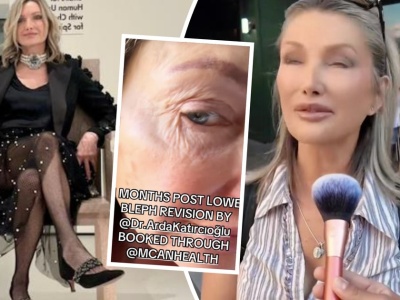 TikTokerka poleciała na operacje plastyczne do Turcji. 