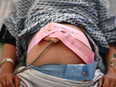 Śmierć po cesarskim cięciu. Kto odpowie za tragedię w Bielsku-Białej?