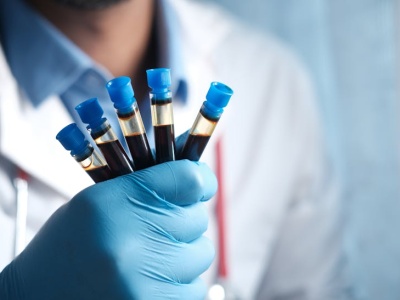 Ponad 36 mln zł dotacji na rozwój kompetencji diagnostów i kadry krwiodawstwa