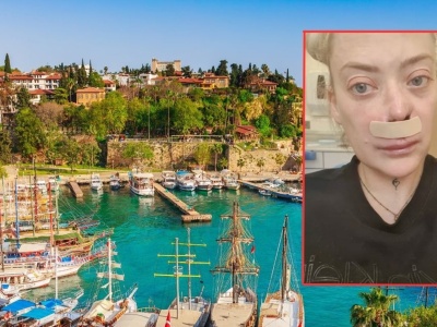 Poszła do dentysty w Turcji. Szok, co stało się potem z jej twarzą