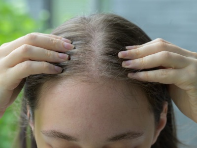 Ludzie myślą, że to nic takiego. A może być bardzo szkodliwe dla włosów. 