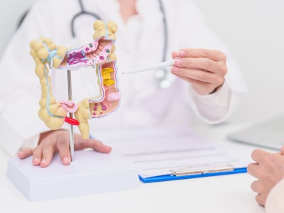 Odkryto nowy sposób leczenia raka jelita grubego i wątroby. Przełomowe wyniki badań