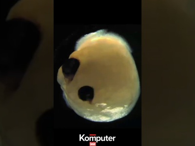 Naukowcy wyhodowali minimózgi. Zaczęły im rosnąć oczy