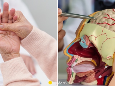 Nowe odkrycie daje nadzieję chorym na Parkinsona. Klucz tkwi w sieci SCAN