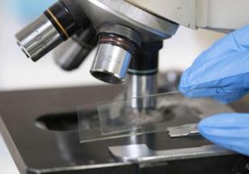 Odkryto najmniejsze bateryjne genomy. Dokonanie polskich naukowców