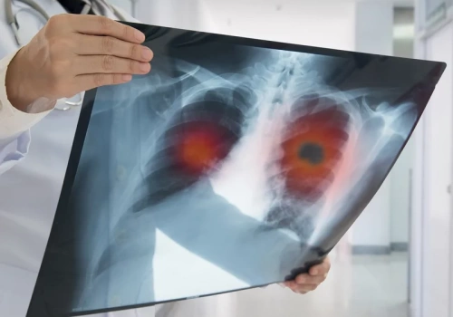 Z lodowiska na onkologię. Były reprezentant kraju wygrywa mecz o zdrowie