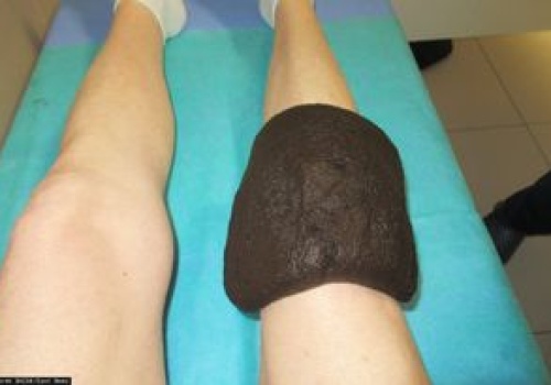 Trzy tygodnie leczenia uzdrowiskowego za darmo. Oto komu przysługuje