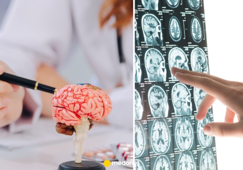 Jest sposób na obniżenie ryzyka demencji. Nawet o 25 proc.