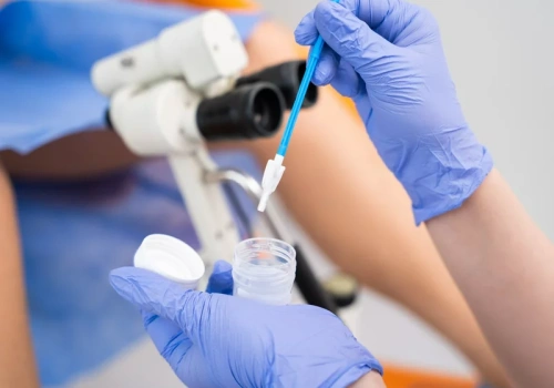 Test, który może uratować życie, można zrobić za darmo na NFZ