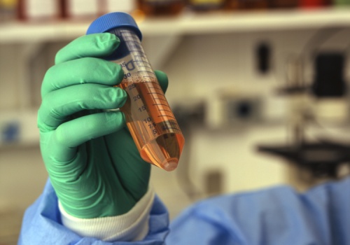 Rak trzustki w odwrocie? Już niedługo może nie być problemem