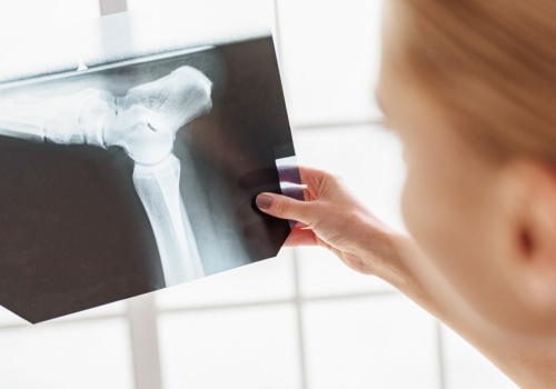 Odczytali, jak ćwiczenia budują mocniejsze kości. Osteoporoza nie ma szans