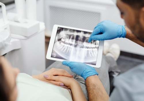 Zgryz krzyżowy przedni wiąże się ze zwiększonym ryzykiem utraty zębów