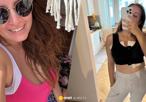 Magda zmniejszyła piersi z rozmiaru N do C. 