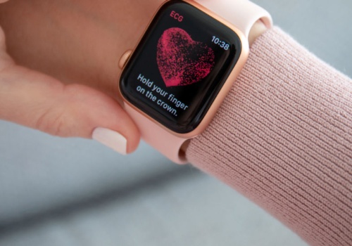 Czym różni się EKG z Apple Watch od szpitalnego? Przekonałem się osobiście