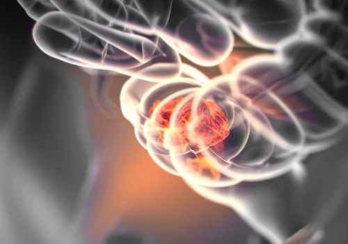 Najpoważniejsze czynniki ryzyka raka jelita grubego. Wiele zależy od naszego stylu życia